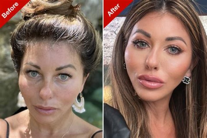 Did Kathy Hochul Do Plastic Surgery On Her Face? Before And After Pictures Of The Governor