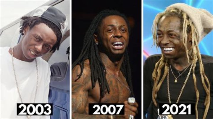 Has Lil Wayne Done Face Lift Surgery?