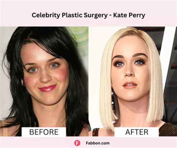 
What Did Carson Kressley Look Like Before And After Plastic Surgery? 