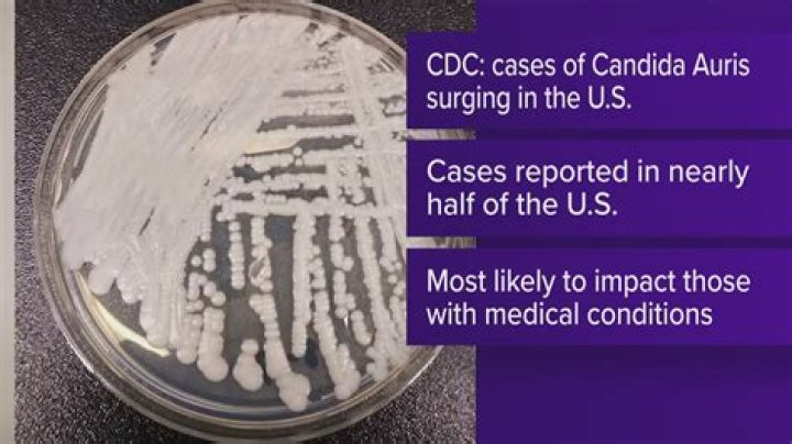 
What does Candida Auris look like on the skin? All about deadly fungus spreading, prevention, symptoms and more 